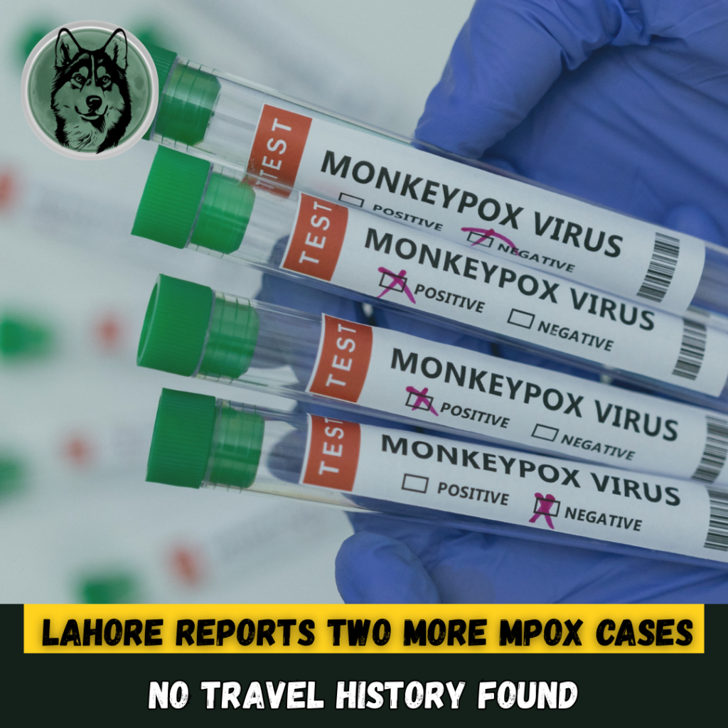 Lahore Reports Two More Mpox Infections, No Travel History Found
